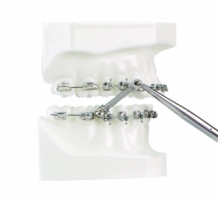 Vector Tas Mini-Screws (6) - Ortho-Solutions Webshop